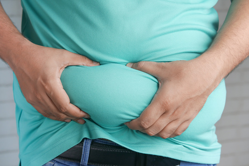 The Correlation Between Obesity and Back Pain
